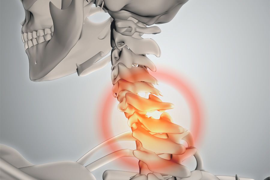 clínica de fisioterapia linares luis carlos diaz alex -TRATAMIENTO FISIOTERAPEÚTICO DE LA HERNIA DISCAL 2