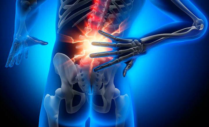 clínica de fisioterapia linares luis carlos diaz alex -TRATAMIENTO FISIOTERAPEÚTICO DE LA HERNIA DISCAL 2