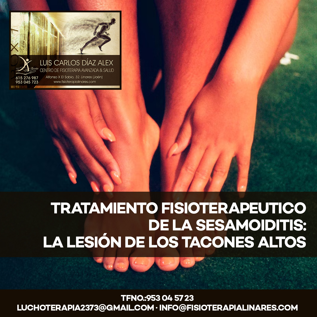 clínica de fisioterapia linares luis carlos diaz alex -TRATAMIENTO FISIOTERAPEUTICO DE LA SESAMOIDITIS LA LESIÓN DE LOS TACONES ALTOS