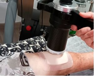 Regeneración de úlcera con Bomba Diamagnética
