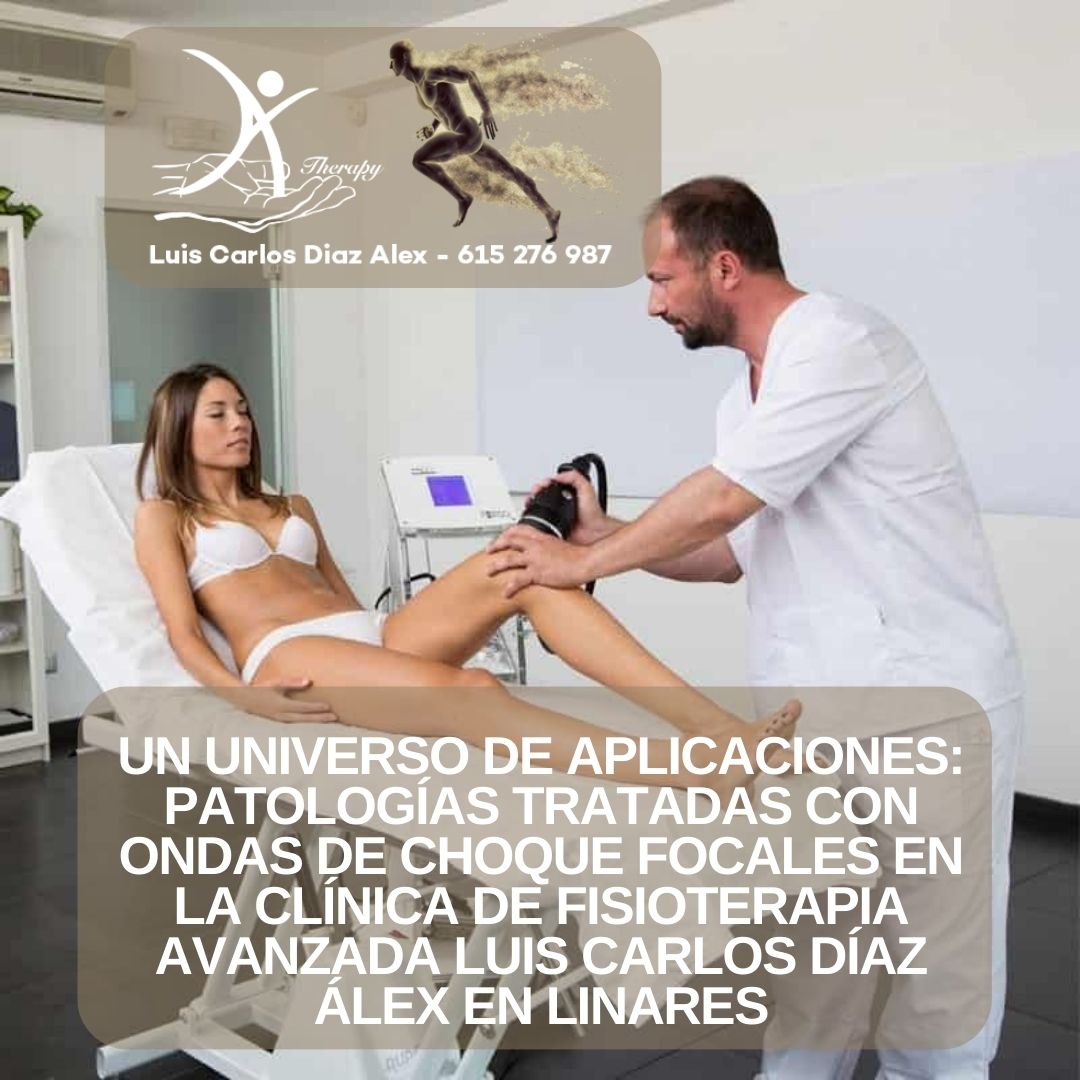 ONDAS DE CHOQUE FOCALES EN LINARES_ LA REVOLUCIÓN TERAPÉUTICA EN LA CLÍNICA DE FISIOTERAPIA AVANZADA LUIS CARLOS DÍAZ ÁLEX PARA EL ALIVIO DEL DOLOR Y LA REGENERACIÓN TISULAR